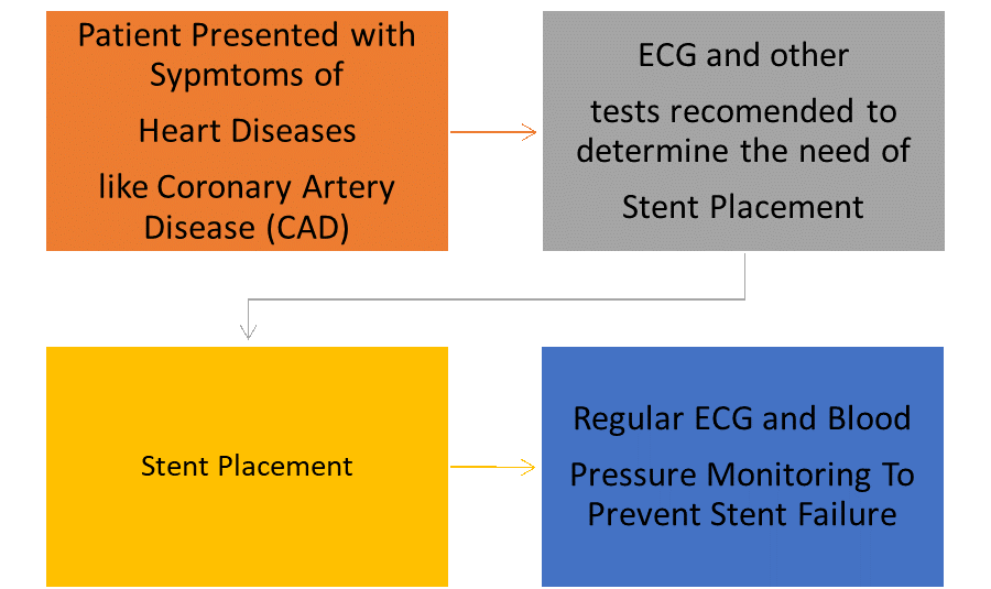 ECG benefit and stent-Agatsa